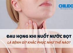 Nuốt Nước Bọt Đau Họng Thì Phải Làm Sao